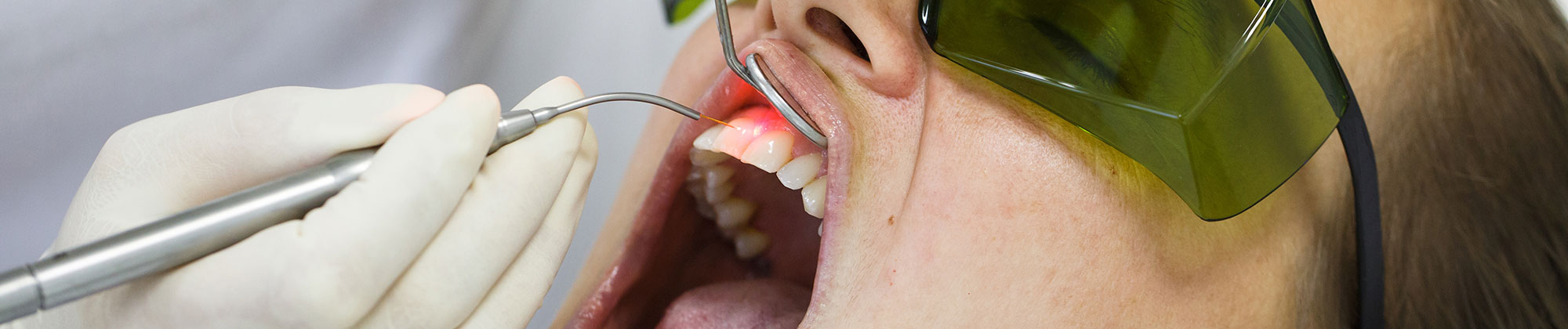 Person undergoing laser dentistry therapy